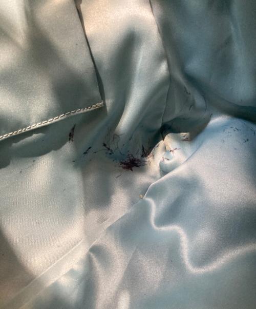 COACH（コーチ）COACH (コーチ) エナメルシグネチャーハンドバッグの古着・服飾アイテム