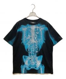 xg（エックスジー）の古着「Alien X-Ray Tee」｜ブラック×ブルー