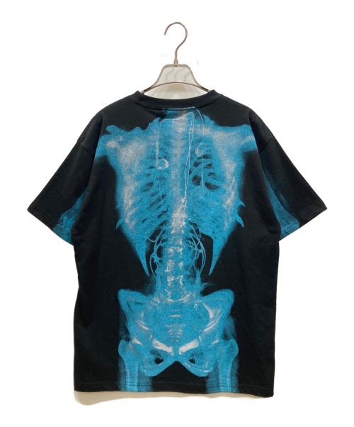 xg（エックスジー）XG (エックスジー) Alien X-Ray Tee ブラック×ブルー サイズ:SIZE Lの古着・服飾アイテム
